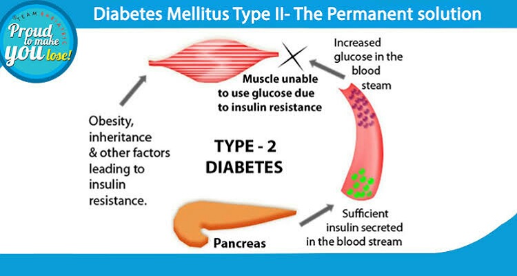 Type 2 diabetes mellitus