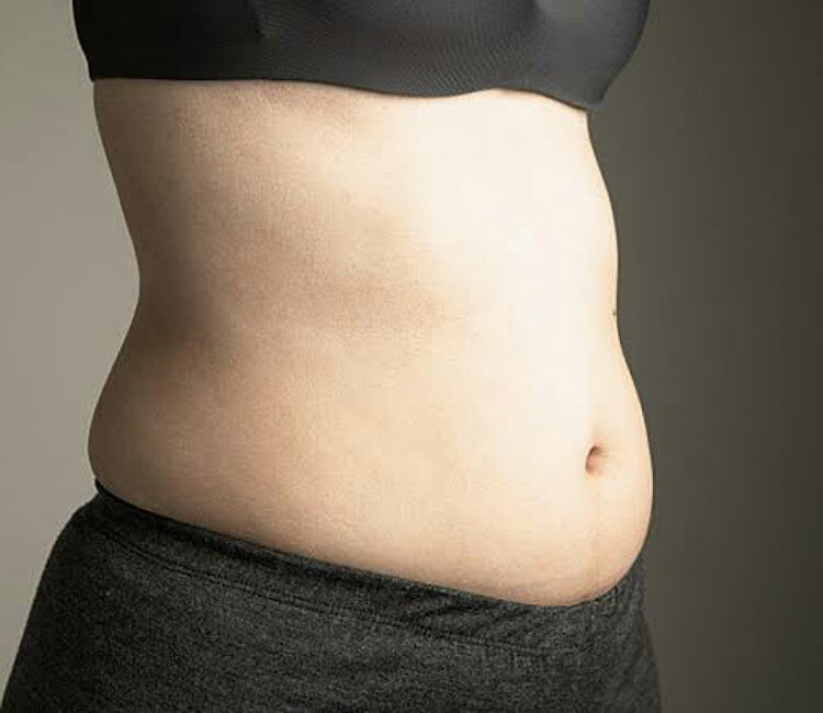 lower belly fat